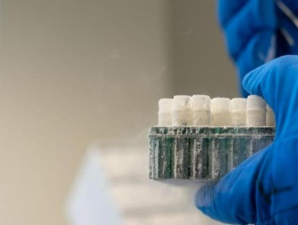  Cryogenic Biobanking Services Market SWOT Analysis by Leading Key Players: BioCision, Cryoport, Thermo Scientific 