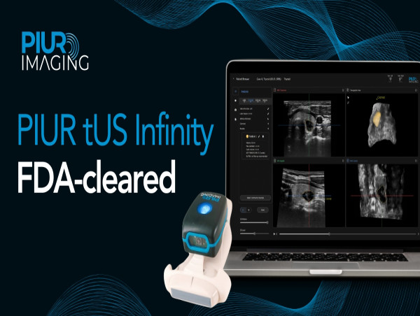  PIUR IMAGING Receives FDA Clearance for Revolutionary 3D Ultrasound Technology, PIUR tUS Infinity, Now Available in U.S. 