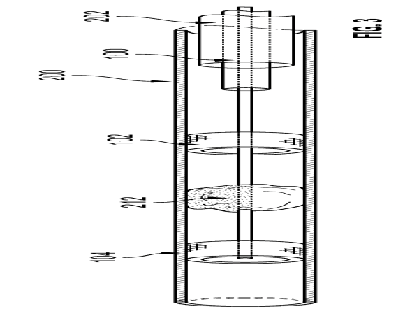  Retriever Medical Announces Notice of Allowance for Innovative Clot Removal Device 