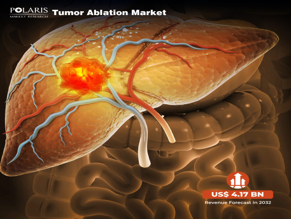  Tumor Ablation Market Size to Achieve US$ 4.17 Billion, Expanding at 11.3% CAGR Forecast By 2024-2032 