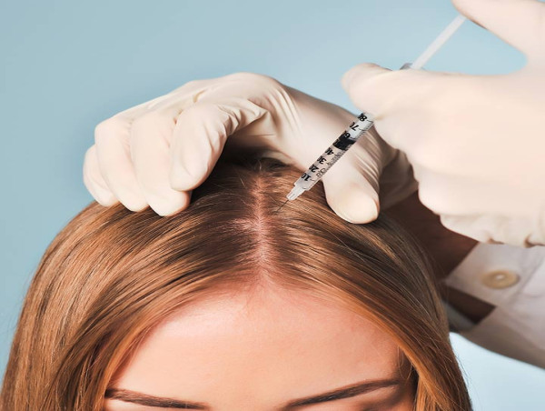  Prescription Hair Loss and Hair Removal Drugs Market Projected To Witness Substantial Growth, 2024-2031: Cipla Limited 