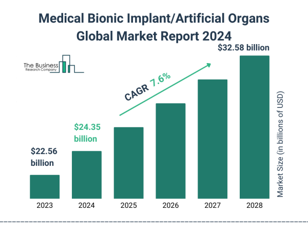  Medical Bionic Implant/Artificial Organs Market Size, Share, Revenue, Trends, and Drivers For 2024-2033 