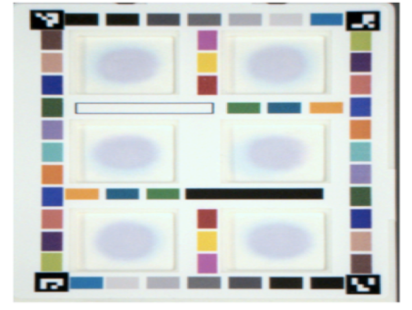 HueDx Transforms Point-of-Care Diagnostics with AI-Powered Smartphone Solutions