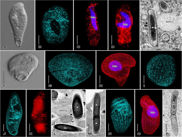 Groundbreaking Study Reveals New Insights into Anaerobic Ciliate and Methanogen Symbiosis