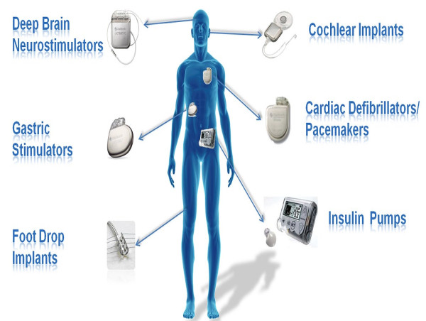  RFID in Healthcare Market Projected To Witness Substantial Growth, 2024-2031: Accenture, Hitachi, Ltd., IBM, 3M 