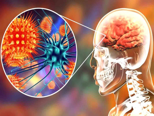  Autoimmune Encephalitis (AIE) Treatment Market Sector Size, Market Trends, and Growth Analysis Report 2024 - 2031 