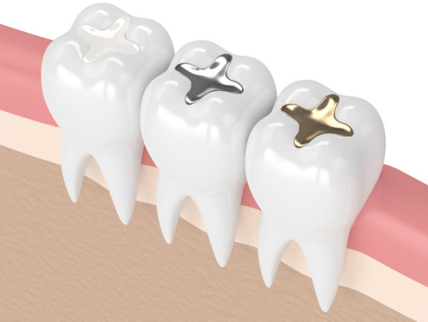  Tooth Filling Materials Market Report, Size, Share Report 2024-2032 