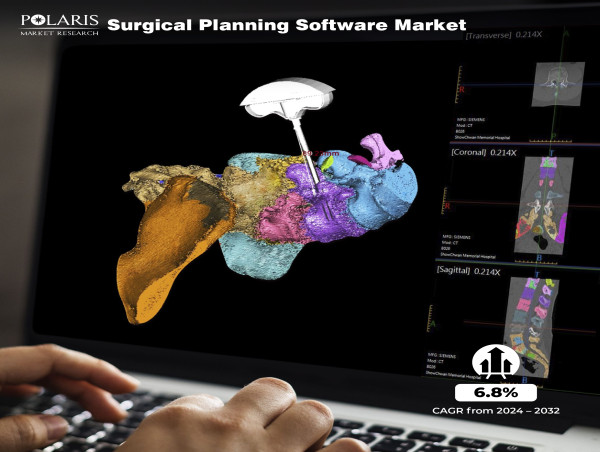  Surgical Planning Software Market on Track to Achieve USD 198.29 Million Value by 2032 with a 6.8% CAGR 