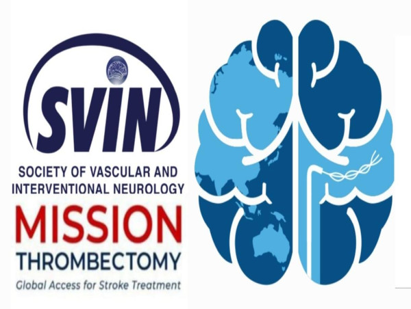  Society of Vascular and Interventional Neurology Mission Thrombectomy Program Announces Groundbreaking Research Paper 