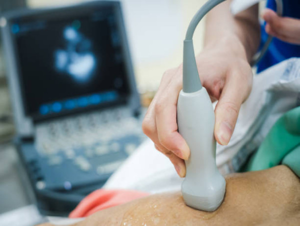 Echocardiography Devices Market: Innovations Driving Growth and Accuracy | Microport Scientific Corporation
