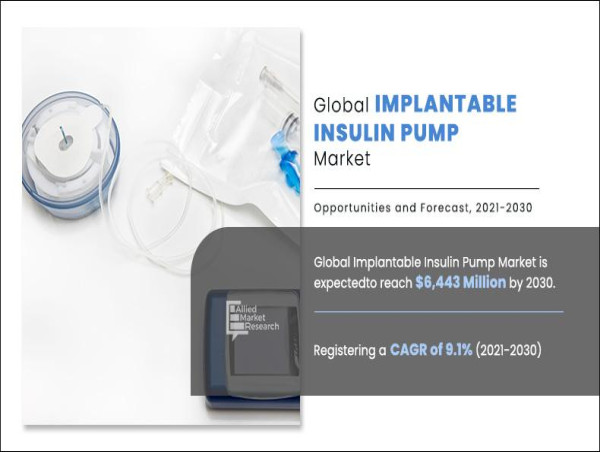  Implantable Insulin Pump Market Worth $6.44 Billion by 2030 | Diabeloop, Diamesco Co., Ltd, F. Hoffmann La Roche Ltd. 