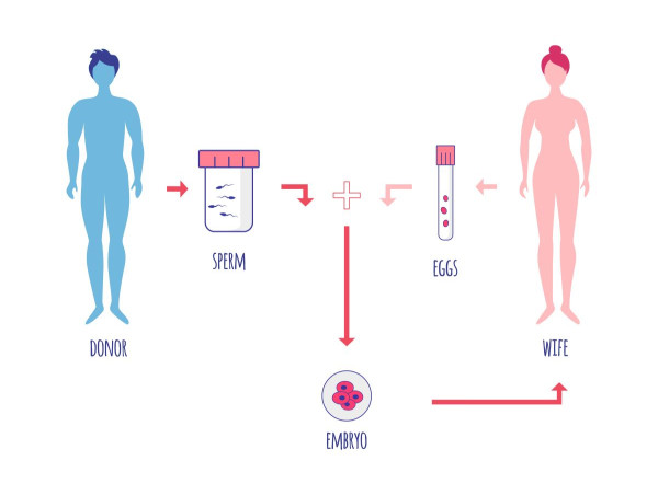  Donor Egg IVF (In-Vitro Fertilization) Market Is Booming Worldwide 2024-2031:Boston IVF, Fairfax EggBank, Virtus Health 
