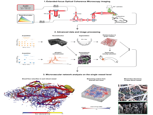  New Imaging Technique Reveals Detailed Map of Brain's Blood Flow in 3D 