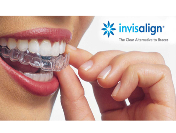  Grey Lynn Invisalign for Teeth Straightening: Adult Orthodontic Treatment Update 