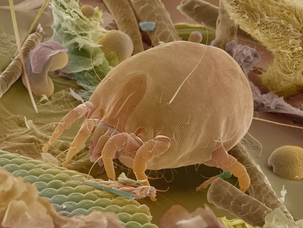  House Dust Mite Allergy Market Growth Driven by Advancements in Allergy Treatments Analysis, Report 2024 - 2031 