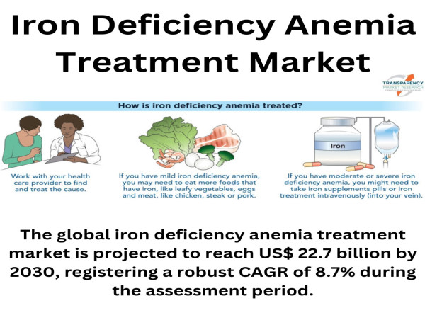  Iron Deficiency Anemia Treatment Market to Achieve US$ 22.7 Billion by 2030, Expanding at 8.7% CAGR - Analysis by TMR 