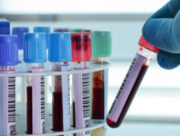  Bovine Blood Plasma Derivatives Market Set to Reach Over USD 3.7 Billion by 2034 | Transparency Market Research 