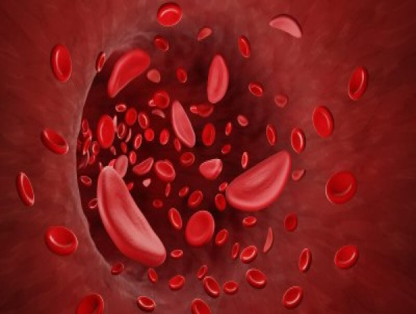  Sickle Cell Disease Treatment Market Expected to Surpass USD 17.7 Billion by 2034 | Transparency Market Research 