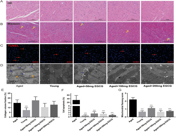  Long-Term Administration Green Tea Catechins Effect on Aging-Related Cardiac Diastolic Dysfunction & Troponin I Decline 