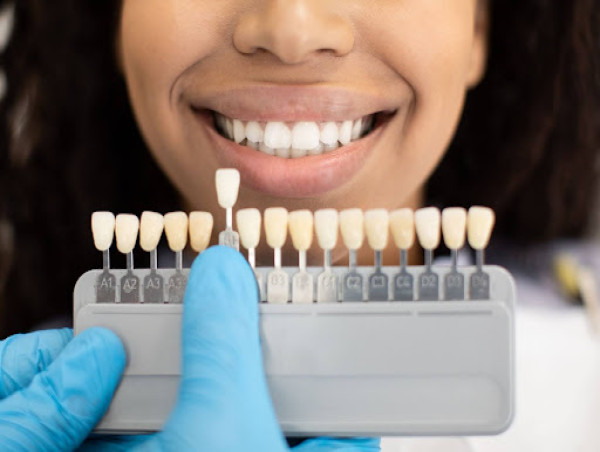  Harris Dental Serves Local Patients With Professional Porcelain Veneers 