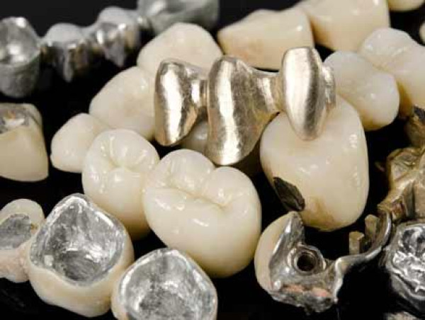  Dental Alloys Market 2025-2031 Is Set To Experience Revolutionary Growth 