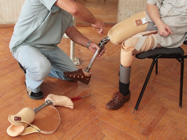  Prosthetics And Orthotics Market Set to Witness Significant Growth by 2025-2032: Ossur, Steeper Group, Blatchford, Inc. 