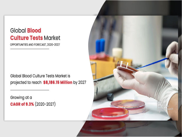  Blood Culture Test Market to Reach $8.18 Bn, Globally, by 2027 at 9.3% CAGR 