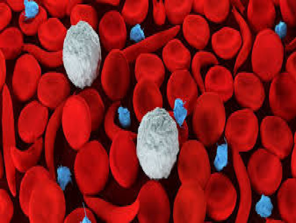 Sickle Cell Disease Treatment Market Deep Research Report Forecast by 2025 to 2032 | Novartis AG, Emmaus Medical Inc.