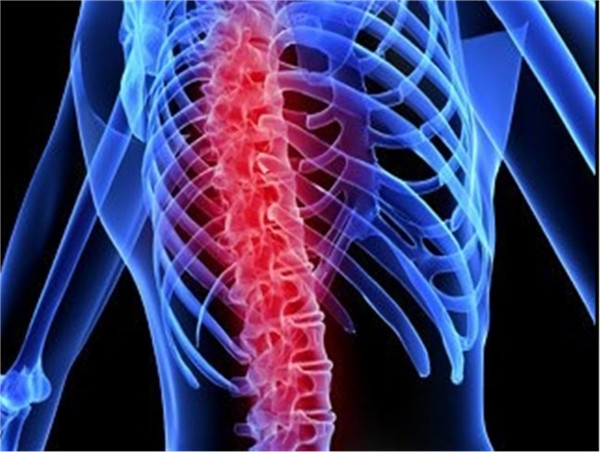  Spinal Cord Injury Therapeutics Market Set to Witness Significant Growth by 2025-2032: ReNetX Bio, Inc, Pfizer Inc 