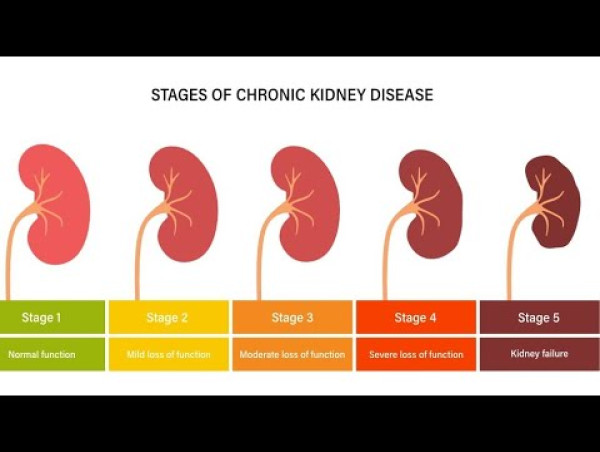  Chronic Kidney Disease Market Forecasted to Reach USD 63.52 Billion By 2032, at an Impressive 5.78% CAGR 