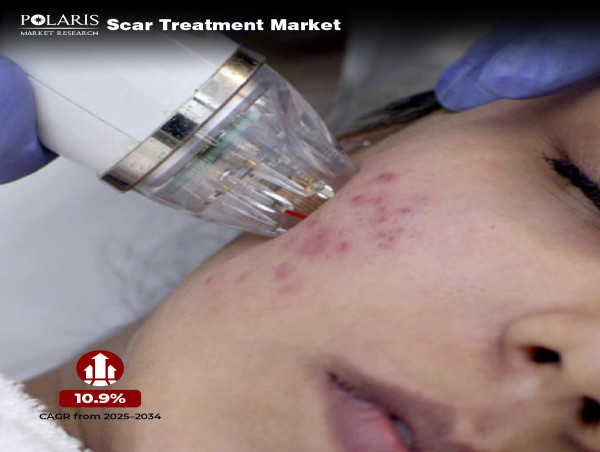  Scar Treatment Market to Surge with 10.9% CAGR, Global Revenue to Exceed US$ 8.24 Billion by 2034 