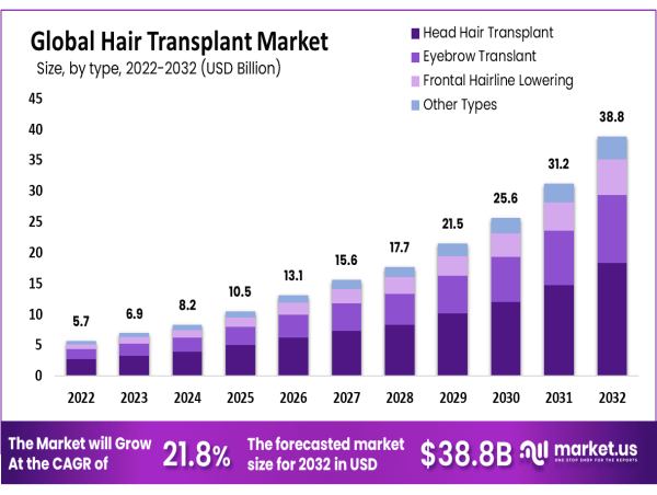  Hair Transplant Market Insights Reach US$ 39 Billion Valuation By 2032 | Type, Method, Gender, End-User Analysis 
