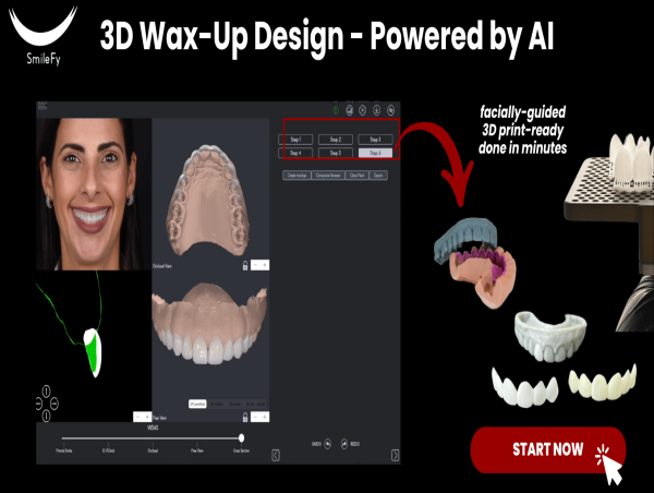  Transforming Digital Dentistry: Smilefy 4.5 Introduces Automated 3D Wax-Up Technology 