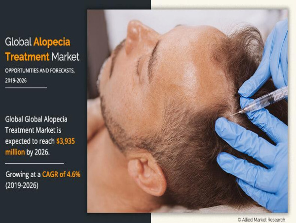 Alopecia Treatment Market Set to Surge to $3,935 Million by 2026 at a 4.6% CAGR