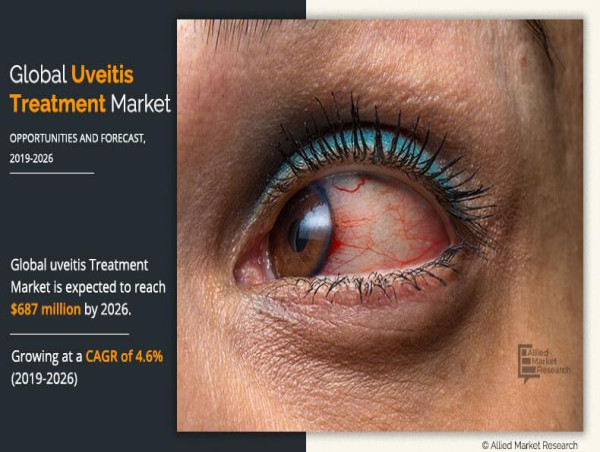  The Global Uveitis Treatment Market: A Comprehensive Overview of Growth, Challenges, and Opportunities 