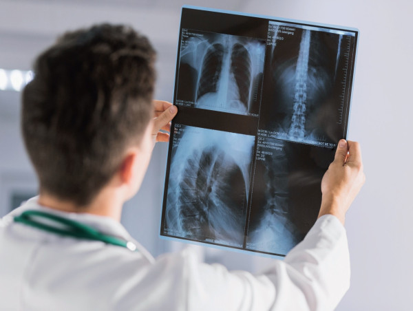  Industrial X Ray Films Market Latest Trends and Opportunities, Analysis Report and Forecast 2032 