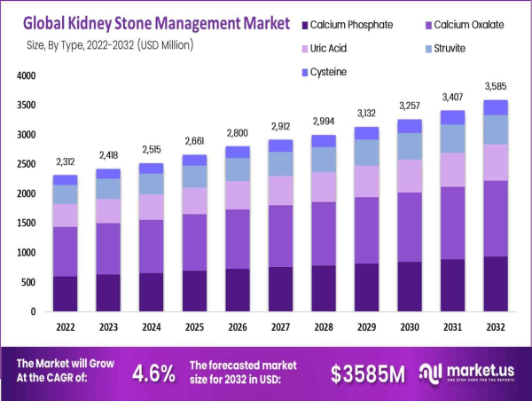  Kidney Stone Management Market To Achieve USD 3,595 Million By 2032, Driven By 4.63% CAGR 