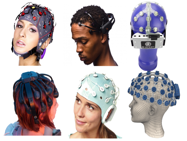  Neurotech Devices Market Projected To Witness Substantial Growth, 2025-2032: Cochlear Limited, Control Bionics, Inc 