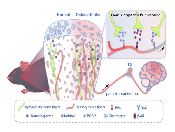  Research Reveals TMJ as Neurogenic, Links to Joint Pain 