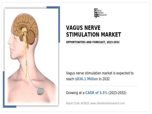  Vagus Nerve Stimulation (VNS) Market Poised for Strong Growth: Key Trends and Opportunities 