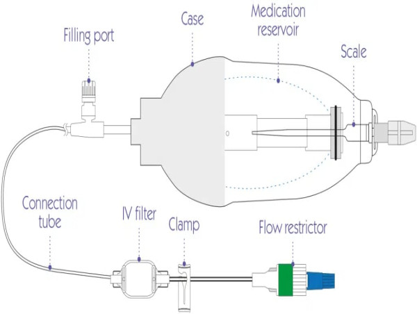  U.S. Elastomeric Infusion Pumps Market Set to Witness Significant Growth by 2025-2032: Baxter International Inc., Werfen 