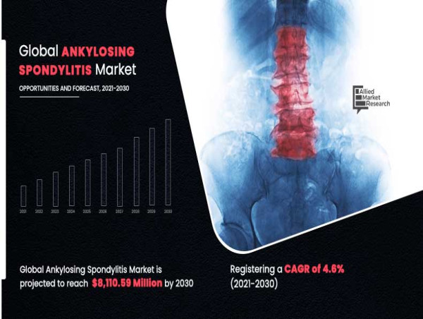  Ankylosing Spondylitis Market: Trends, Challenges, and Future Prospects 