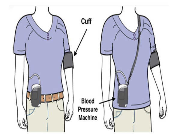  Ambulatory Blood Pressure Monitors Market to Witness Substantial Growth, 2025-2032 |OSI Systems Inc, SunTech Medical Inc 