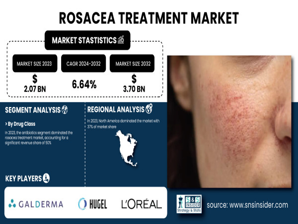  Rosacea Treatment Market Set for Robust Growth to USD 3.70 Billion by 2032 | SNS Insider 