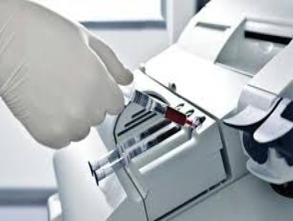  Blood Gas and Electrolyte Analyzer Market Overview, Advancements, Challenges, and Future Outlook 