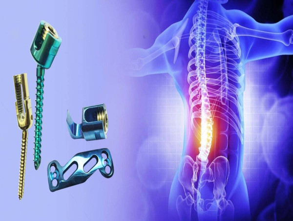 Spinal Implants Market Set to Surge | Advanced Therapies and Growth Outlook 2032: DepuySynthes Companies, Stryker
