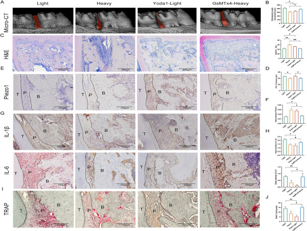 Unraveling the Mechanism Behind Orthodontic Tooth Movement