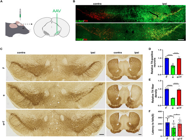  TFE3 Unlocks New Avenues for Parkinson’s Disease Treatment 