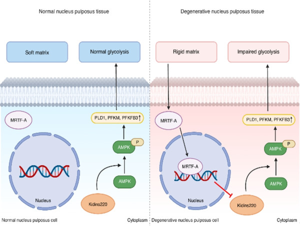 Matrix stiffness and energy crisis in spinal discs: a new pathway to combat degeneration