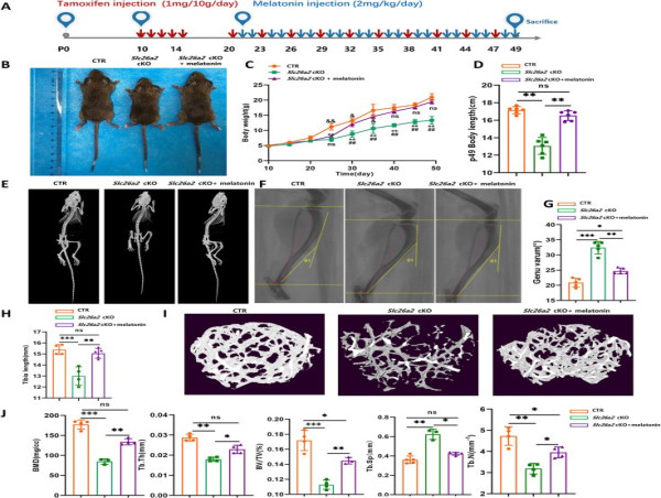 Melatonin Identified as a Potential Therapeutic Agent For SLC26A2-Related Chondrodysplasias